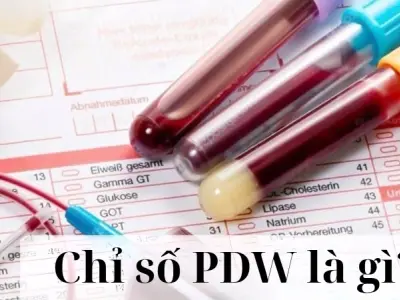 Chỉ số PDW là gì và ý nghĩa trong kết quả xét nghiệm