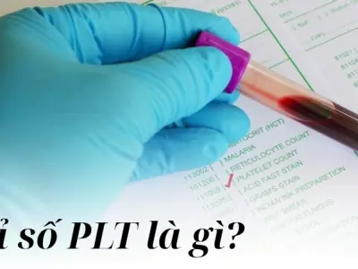 Chỉ số PLT là gì và ảnh hưởng đến sức khỏe ra sao
