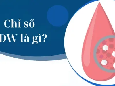 Chỉ số RDW là gì và có ý nghĩa ra sao với sức khỏe