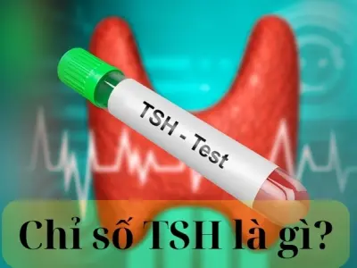 Chỉ số TSH là gì và ý nghĩa trong chẩn đoán bệnh