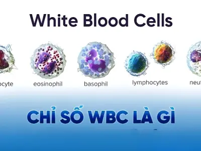 Chỉ số WBC là gì và ý nghĩa trong xét nghiệm máu