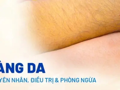 Da vàng có bị sao không dấu hiệu cảnh báo sức khỏe