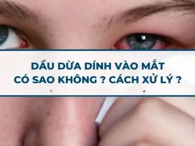 Dầu dừa vào mắt có bị sao không? Giải đáp chi tiết