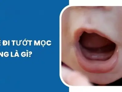 Em bé bị tướt có sao không và cách xử lý hiệu quả
