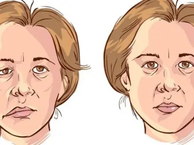 Giật cơ mặt có bị sao không? Nguyên nhân và cách xử lý