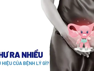 Khí hư ra nhiều có bị sao không bạn cần biết điều này