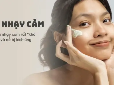 Như thế nào là da nhạy cảm? Cách chăm sóc da đúng chuẩn