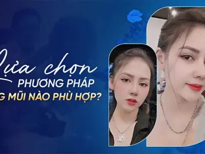 Bật mí 7 mẹo hiệu quả giúp tiết kiệm chi phí nâng mũi