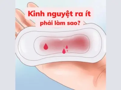 Máu kinh ra ít có bị sao không và những dấu hiệu cảnh báo