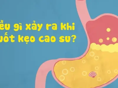 Nuốt singum có bị sao không và cách xử lý kịp thời