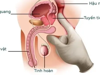 Quan hệ cửa sau có bị sao không và ảnh hưởng sức khỏe