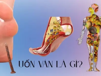 Uốn ván là như thế nào? Hiểu rõ để chủ động phòng ngừa