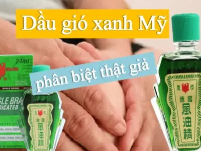 Cách phân biệt dầu xanh thật giả - Dùng dầu xanh giả có độc không?