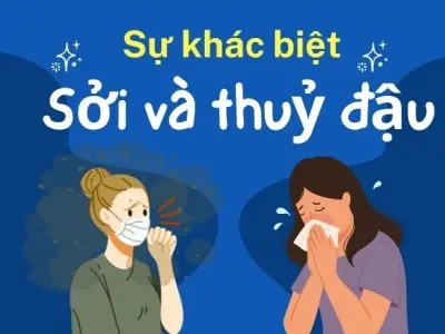 Phân biệt sởi và thủy đậu - Cách nhận biết và xử lý đúng cách