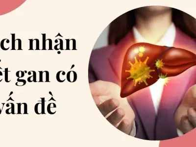 Cách nhận biết gan có vấn đề mà nhiều người không hay