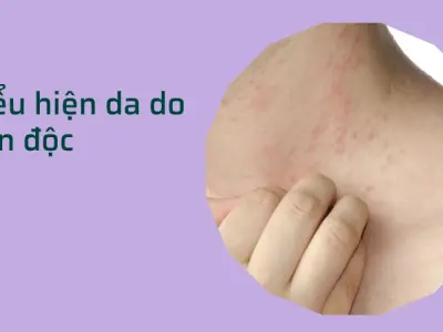 Cách nhận biết gan bị nhiễm độc sớm để bảo vệ cơ thể