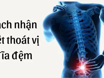 Cách nhận biết thoát vị đĩa đệm qua cơn đau buổi sáng