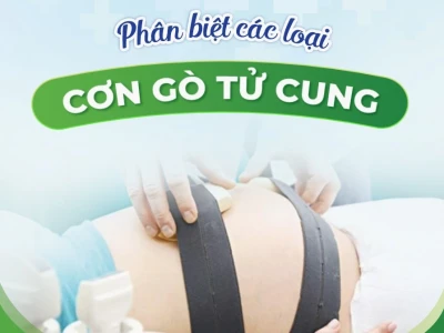 Cơn gò chuyển dạ như thế nào dấu hiệu sắp sinh