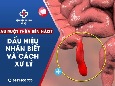 Đau ruột thừa như thế nào? Dấu hiệu nhận biết và cách xử lý sớm