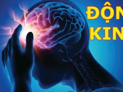 Động kinh là như thế nào? Nguyên nhân, triệu chứng và cách điều trị hiệu quả