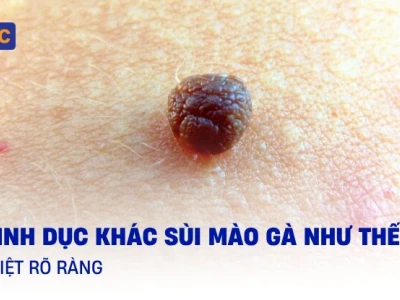 Gai sinh dục: Nguyên nhân, nhận biết và cách xử lý hiệu quả