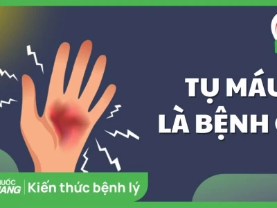 Hematoma là gì? Nguyên nhân, dấu hiệu và cách xử trí hiệu quả