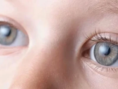 Mắt trẻ sơ sinh như thế nào là bình thường và dấu hiệu bất thường cần lưu ý