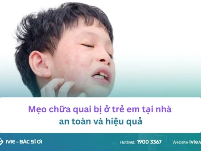 Mẹo chữa quai bị ở trẻ em an toàn và hiệu quả tại nhà