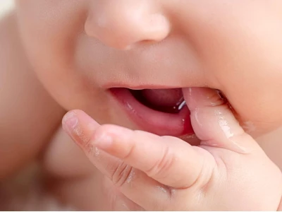 Mẹo Dân Gian Chữa Sốt Mọc Răng Cho Bé Hiệu Quả Tại Nhà