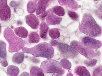 Mycoplasma là gì? Hiểu rõ về vi khuẩn Mycoplasma và cách phòng tránh