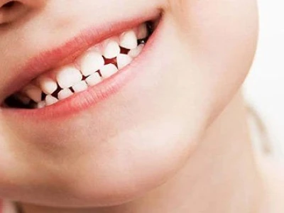 Răng Sữa Là Gì? Tất Tần Tật Thông Tin Cần Biết Cho Bé