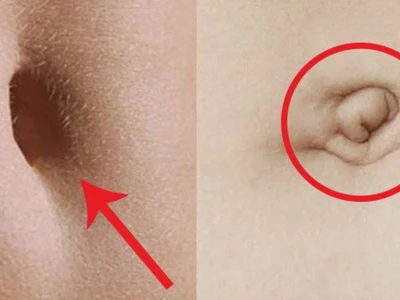 Rốn Đẹp Là Như Thế Nào? Ý Nghĩa và Tiêu Chuẩn Sắc Đẹp