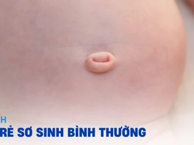 Rốn Trẻ Sơ Sinh: Dấu Hiệu Bình Thường và Khi Nào Cần Lo Lắng