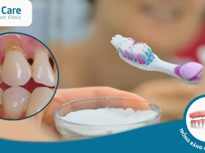 Tác hại của Baking Soda: Những nguy cơ tiềm ẩn bạn cần biết