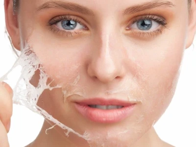 Tác hại của việc peel da: Những rủi ro bạn cần biết