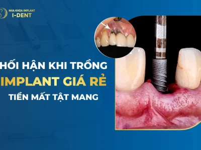 Tác hại của việc trồng răng implant và những lưu ý quan trọng