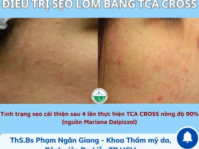 TCA là gì? Hướng dẫn cách xử lý sẹo hiệu quả tại nhà