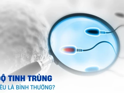 Tinh trùng là gì? Cấu tạo, chức năng và các yếu tố ảnh hưởng