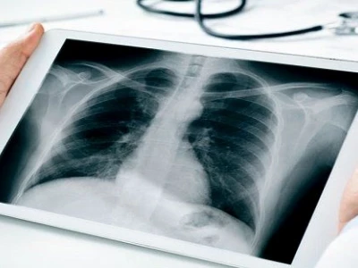 X-ray là gì? Khám phá kỹ thuật chẩn đoán hình ảnh quan trọng